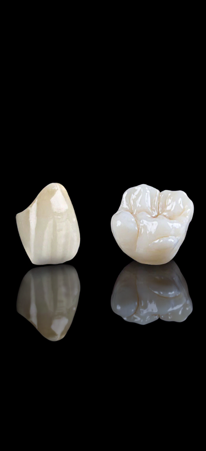 Porcelain Crown